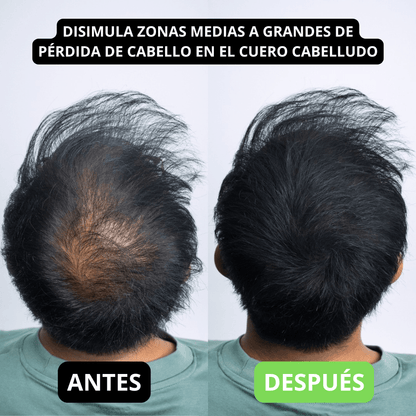 Hair Volume Powder for Men & women - Trendart