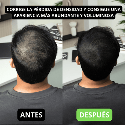 Hair Volume Powder for Men & women - Trendart