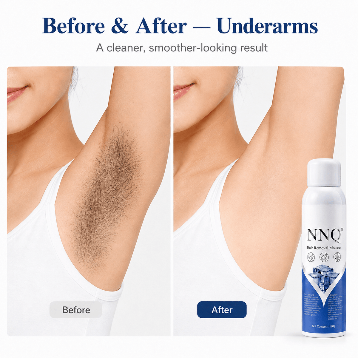 NNQ hair Removal Spray for Men & Women - Trendart