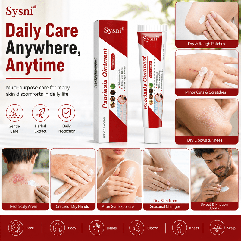 SYSNI PsoriCalm™Sensitive SkinCare Cream - Trendart